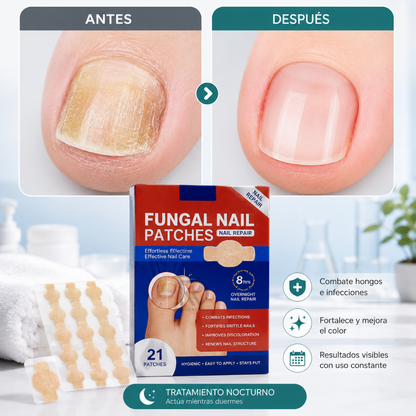 NailPure™ - Recupera el aspecto natural de tus uñas.