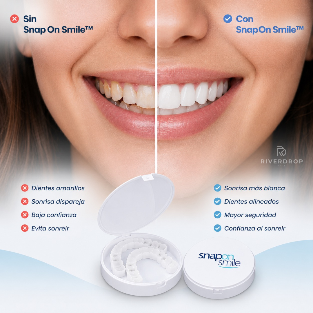 Snap On Smile™ - Confianza instantánea en tu sonrisa