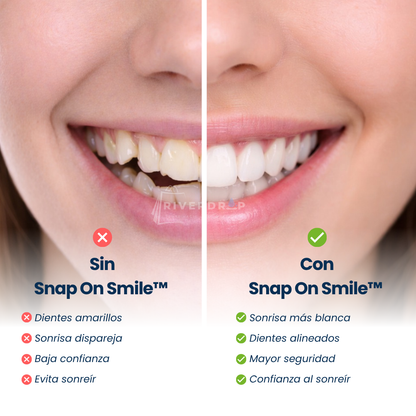 Snap On Smile™ - Confianza instantánea en tu sonrisa