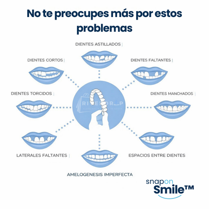 Snap On Smile™ - Confianza instantánea en tu sonrisa