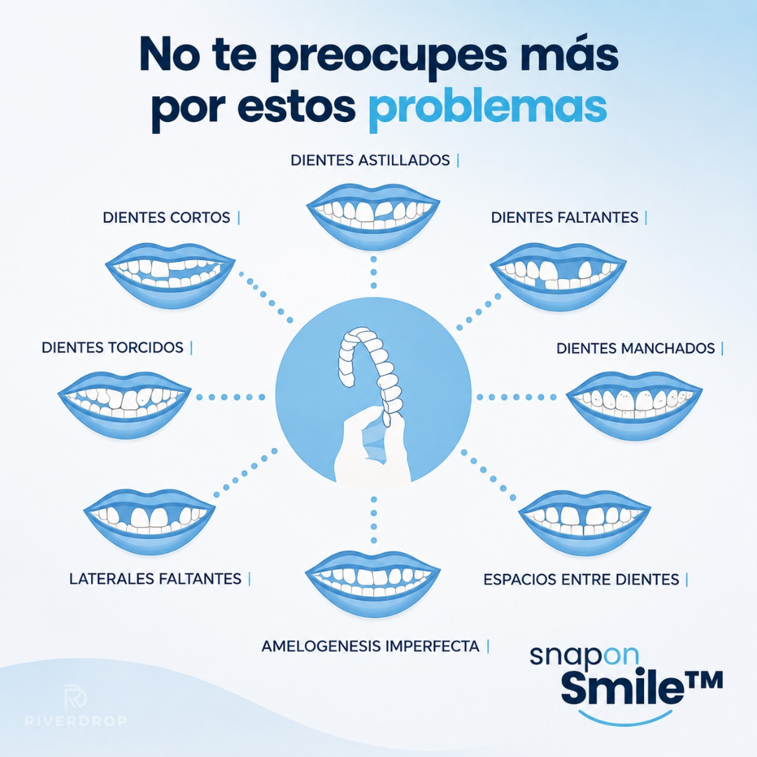 Snap On Smile™ - Confianza instantánea en tu sonrisa
