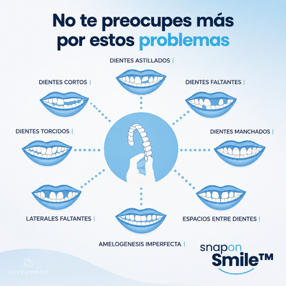 Snap On Smile™ - Confianza instantánea en tu sonrisa