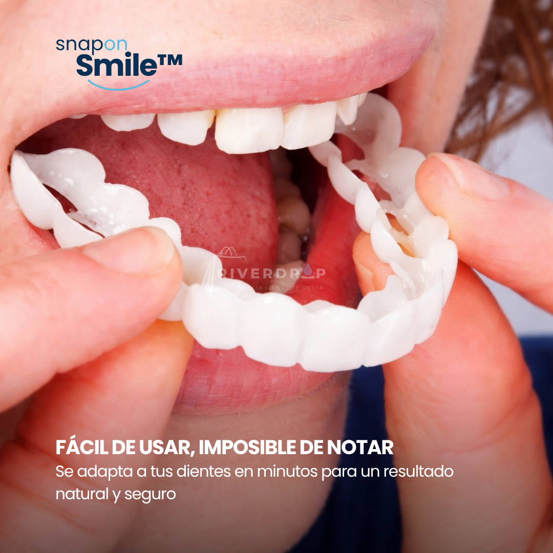 Snap On Smile™ - Confianza instantánea en tu sonrisa