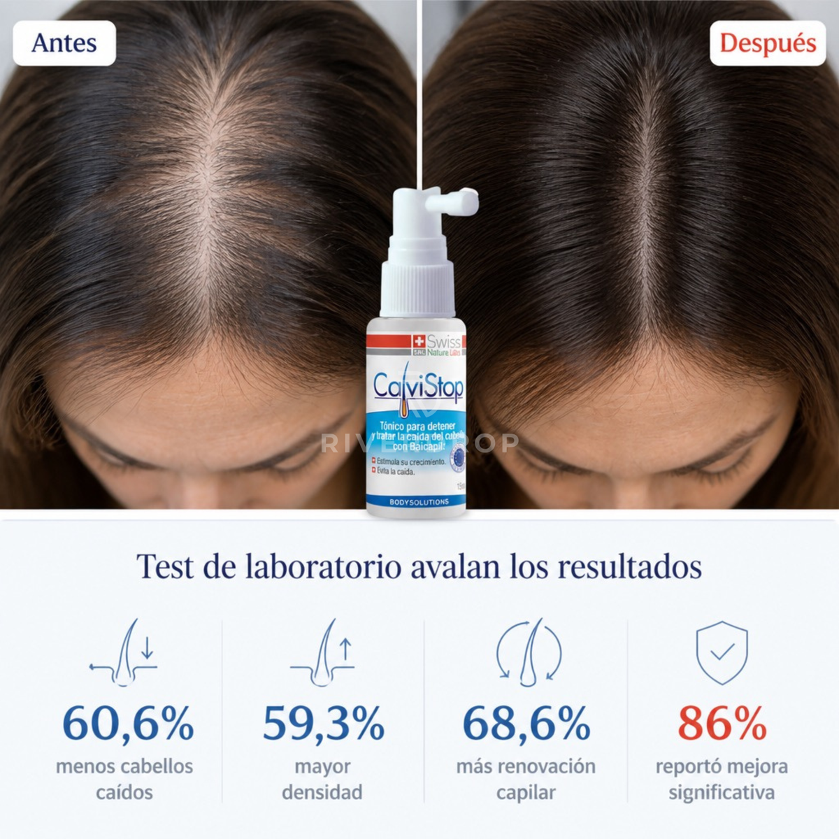 CalviStop™ - Reactiva lo que creías perdido
